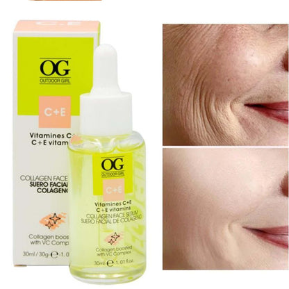 Vitamin C + E Collagen Face Serum – Brightening, Whitening, Wrinkles, Fine Lines & Dark Spot Removal