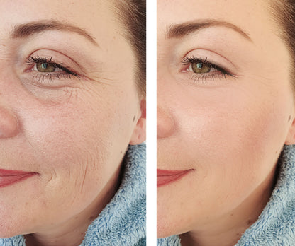 Aurum Multi Peptide Serum – Anti-Aging, Firming & Wrinkle Reduction