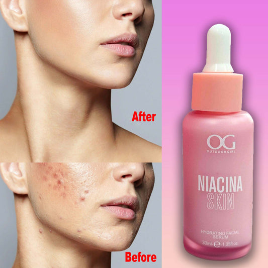 NiaCina Hydrating Facial Serum – Acne Remove, Reduce Dark Spots, Open Pore Refining & Brightening Formula