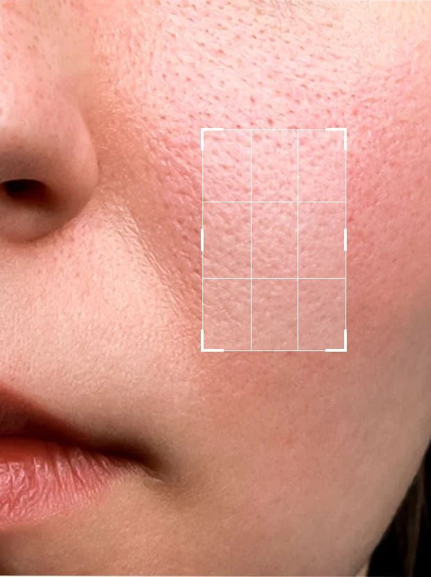 NiaCina Hydrating Facial Serum – Acne Remove, Reduce Dark Spots, Open Pore Refining & Brightening Formula